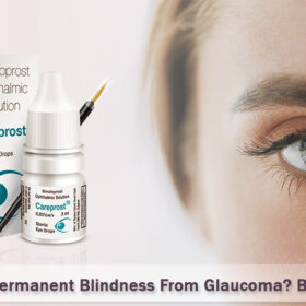 Want To Prevent Permanent Blindness From Glaucoma Buy Careprost Now copy