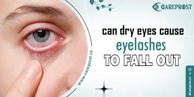 can dry eyes cause eyelashes to fall out