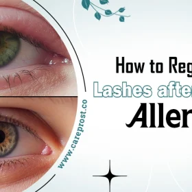 How to Regrow Your Lashes after Cosmetic Allergies